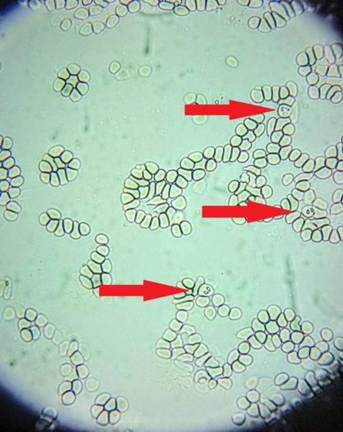 Nombreux piroplasmes dans le sang d'un chien